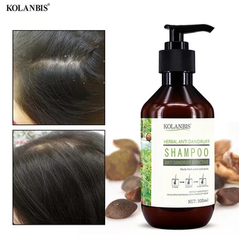 El cuidado del cabello orgánicos a base de hierbas naturales de sulfato de libre anti caspa semillas de té de champú para el pelo para detener la picazón y el cabello graso